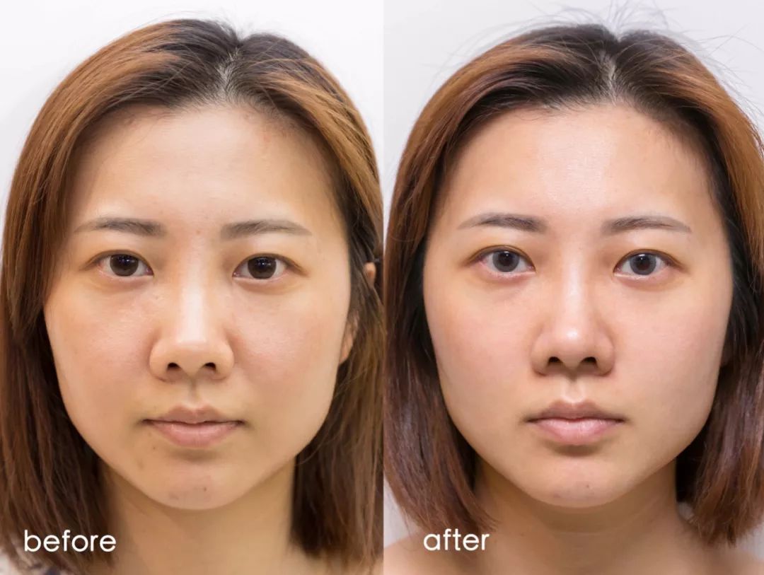 小茂肌诊室∣记一次网红咖啡店里的特别出诊