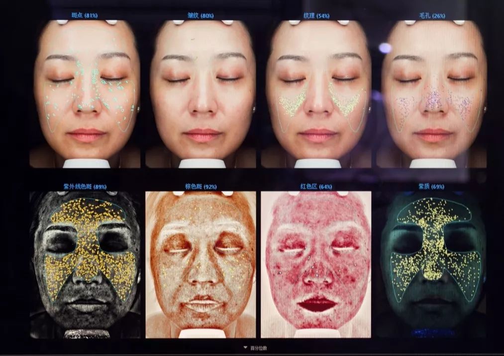 小茂肌诊室∣记一次网红咖啡店里的特别出诊