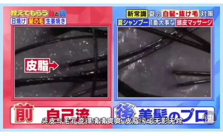 头发多久洗一次最好大多数都错了,头发多久洗一次比较合理