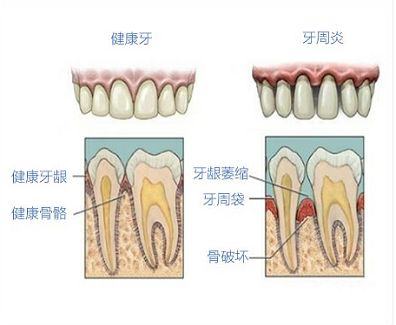 周而复始牙痛不止