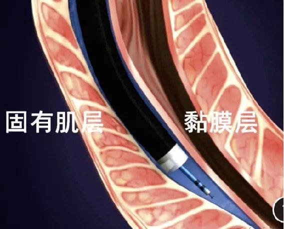 复旦中山内镜中心,复旦大学附属医院内镜中心在哪里