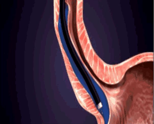 复旦中山内镜中心,复旦大学附属医院内镜中心在哪里