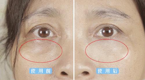 不起眼的乳膏有哪些,药店有一种不起眼的乳膏