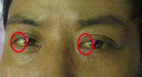 适合熬夜的护眼神器,眼睛疲劳用什么护眼神器