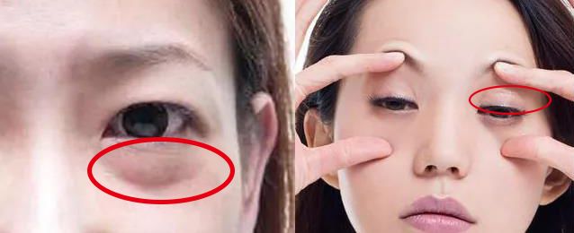 适合熬夜的护眼神器,眼睛疲劳用什么护眼神器