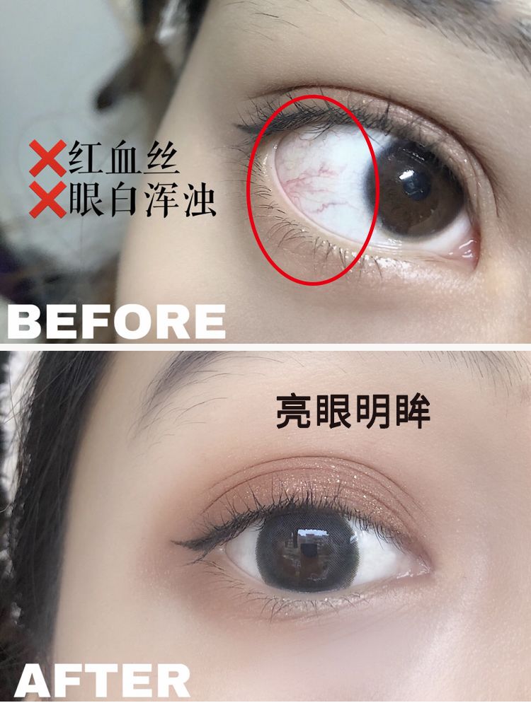 适合熬夜的护眼神器,眼睛疲劳用什么护眼神器