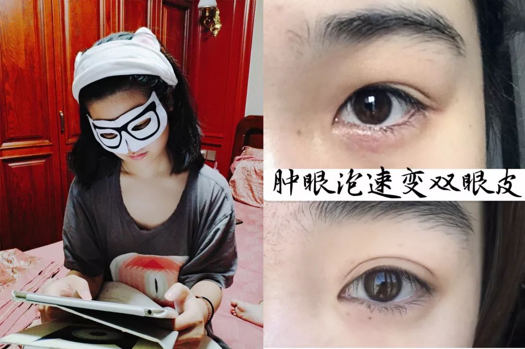 适合熬夜的护眼神器,眼睛疲劳用什么护眼神器