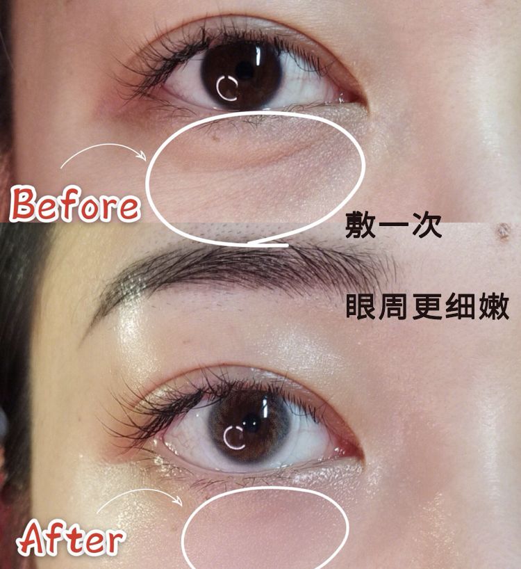 适合熬夜的护眼神器,眼睛疲劳用什么护眼神器