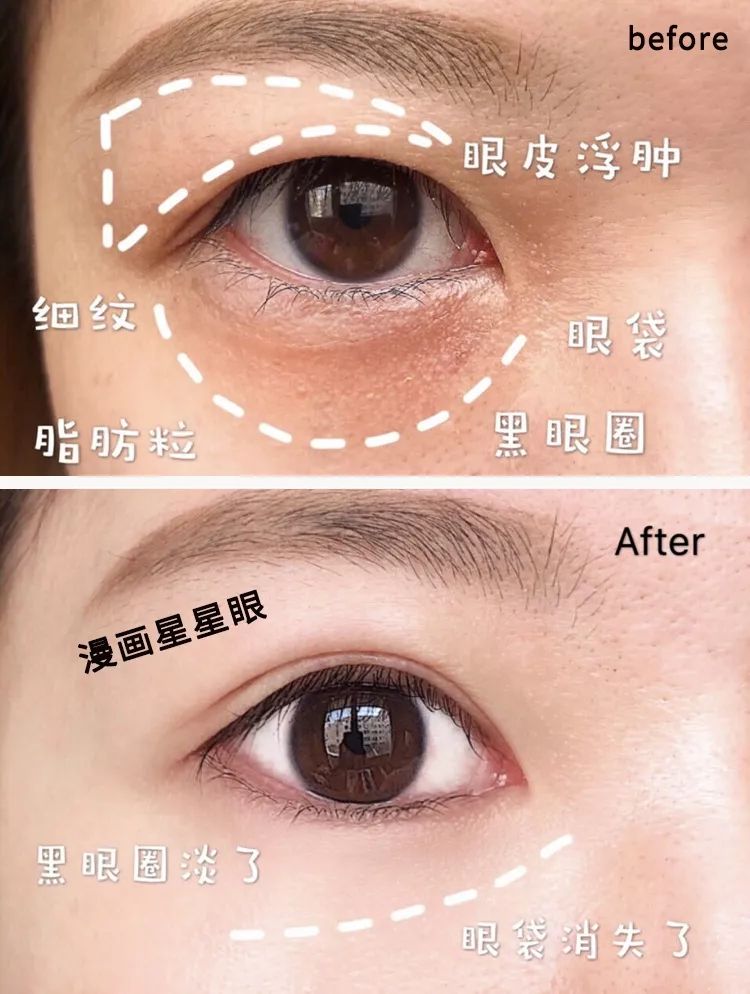 适合熬夜的护眼神器,眼睛疲劳用什么护眼神器