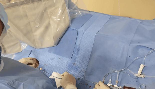 心脏造影和支架一起做大概多少钱,心脏造影支架视频全过程