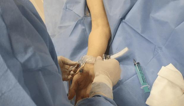 心脏造影和支架一起做大概多少钱,心脏造影支架视频全过程