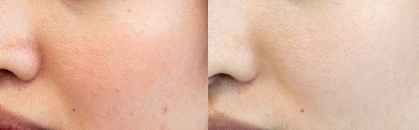 护肤精品9.9专场,护肤9.9团购