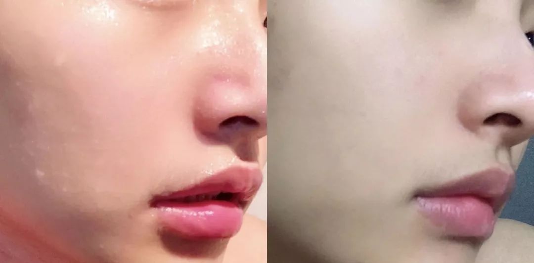 麻范儿好物|波兰国宝级面膜,堪称比“晒后美白针”,每片含有3.6斤羊奶精华