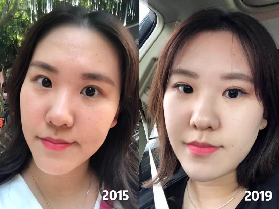 有什么好的口服胶原蛋白推荐,如何买到正宗的三型胶原蛋白