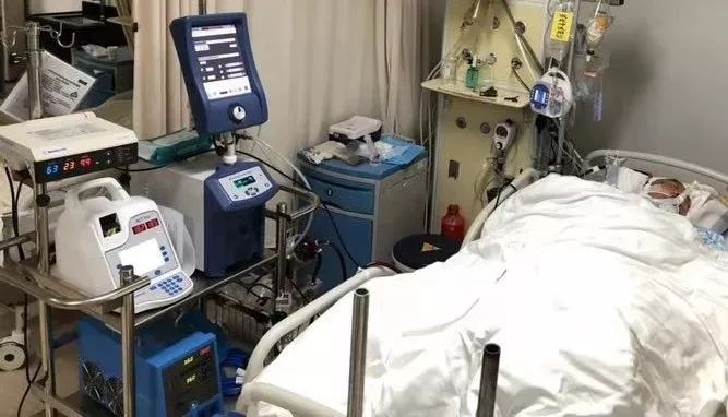 心肺“休息”10天后恢复正常，这个东西救了他一命