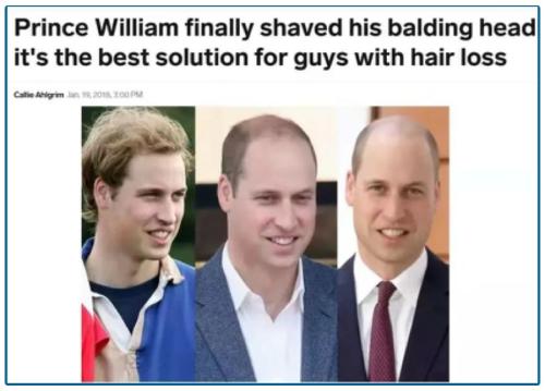 2.5亿人的烦恼男神女神大佬都躲不过却引爆了千亿市场