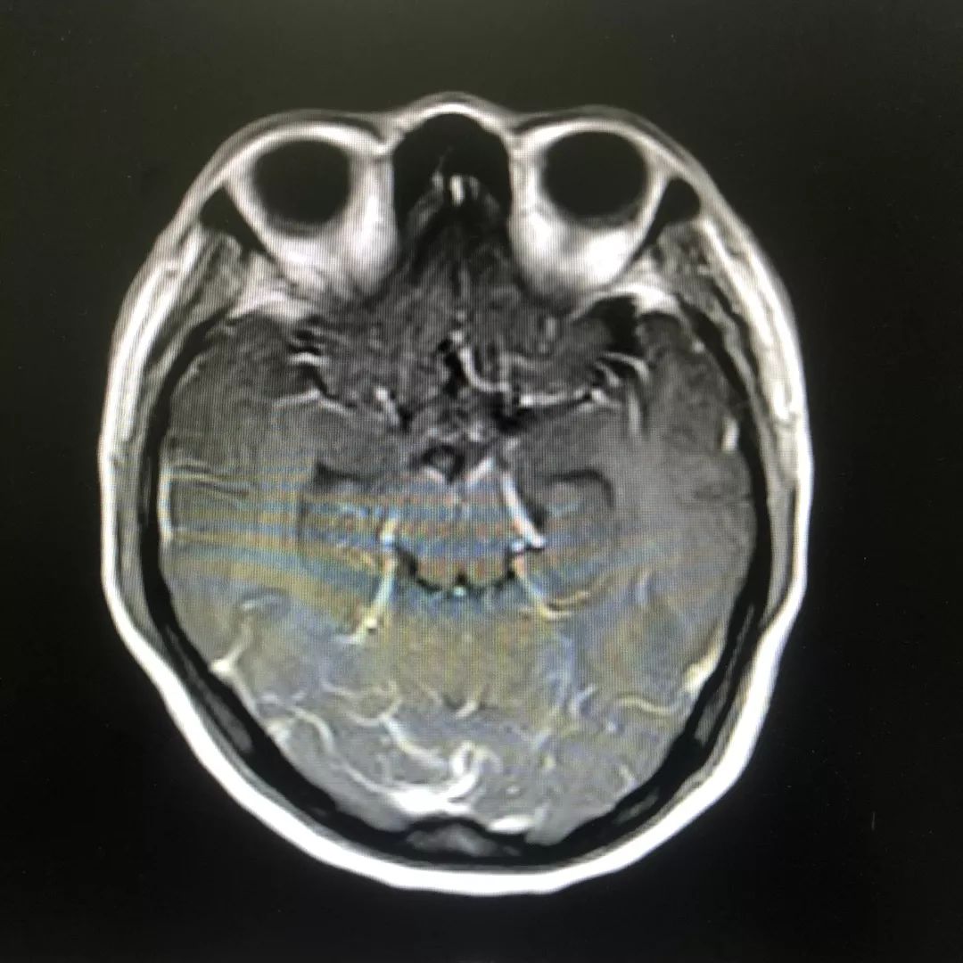 女的经常胡言乱语是什么病,女性胡言乱语疯疯癫癫是怎么回事