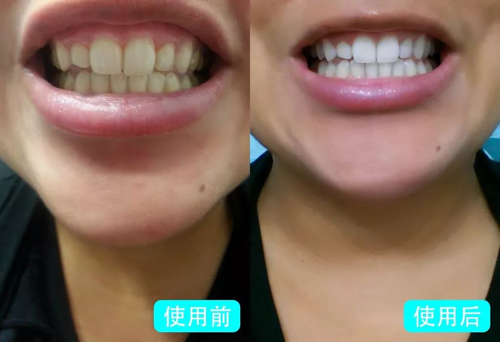 让你口吐芬芳的清新口气牙膏,刷牙口气清新又健康的牙膏