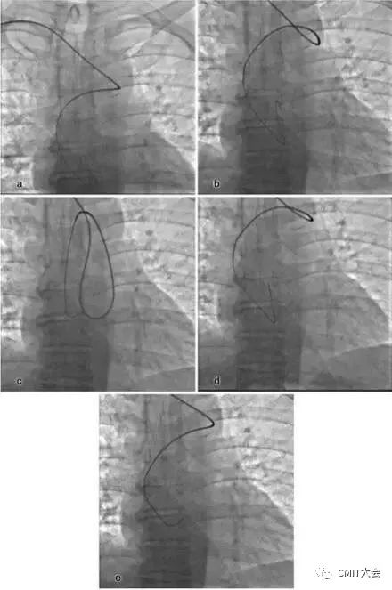 跟我学技术分析从入门到精通,跟我学技术