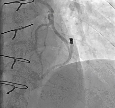 跟我学技术分析从入门到精通,跟我学技术