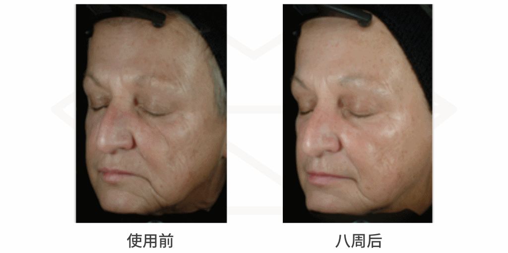 各种美白成分的优缺点,小众美白成分排行榜有哪些