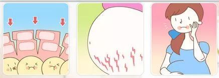 听说准妈妈都怕它,新手妈妈都快被它折磨到抑郁...