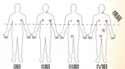 肿瘤病人的科普,科普肿瘤科视频宣教