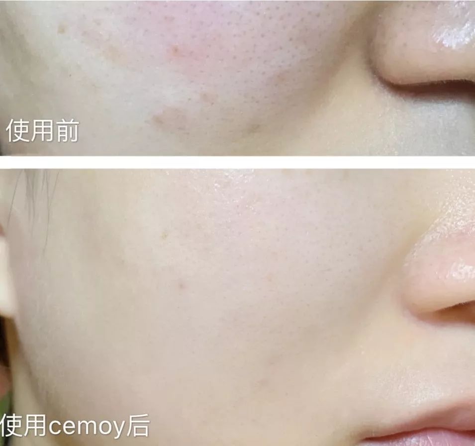 坚决不做“黄脸婆”!有了它,再差的皮肤都有救!丨开团