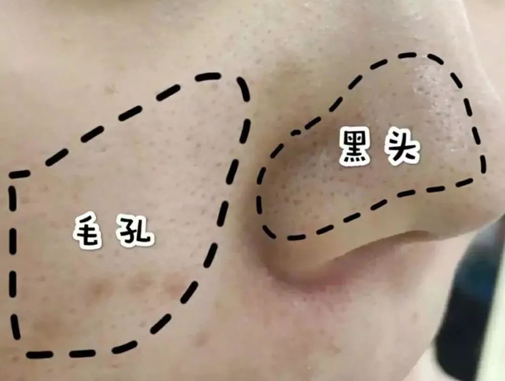 坚决不做“黄脸婆”!有了它,再差的皮肤都有救!丨开团