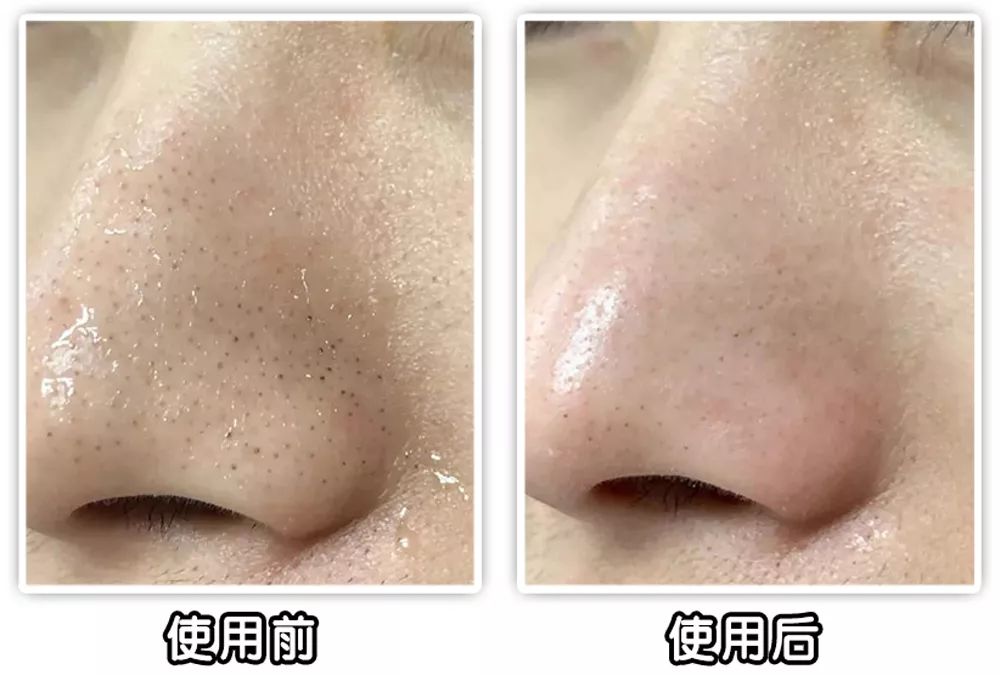 坚决不做“黄脸婆”!有了它,再差的皮肤都有救!丨开团