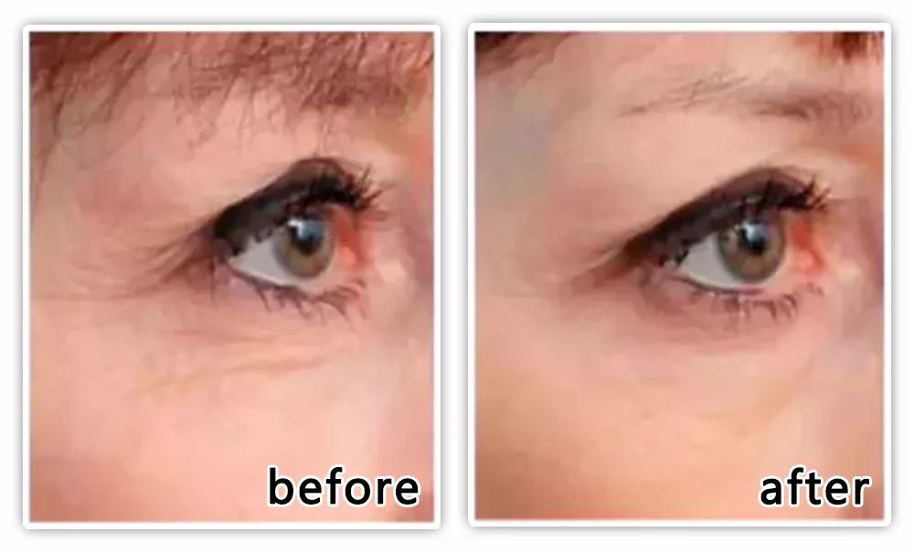 坚决不做“黄脸婆”!有了它,再差的皮肤都有救!丨开团