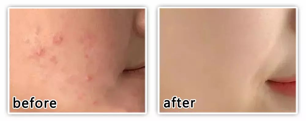 坚决不做“黄脸婆”!有了它,再差的皮肤都有救!丨开团