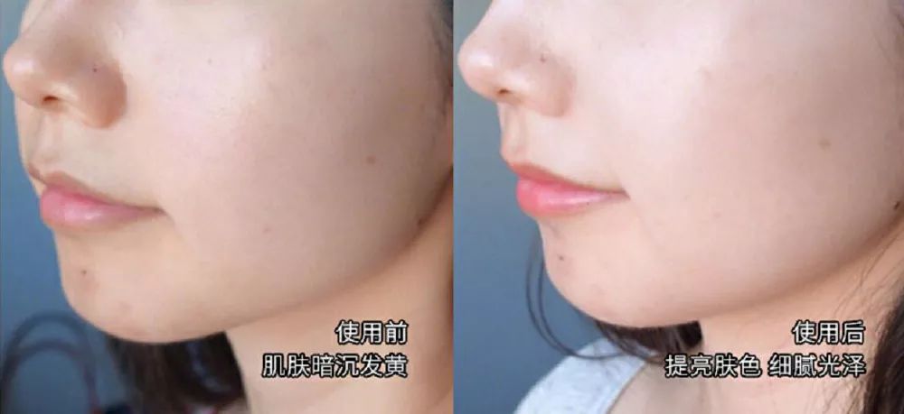 坚决不做“黄脸婆”!有了它,再差的皮肤都有救!丨开团