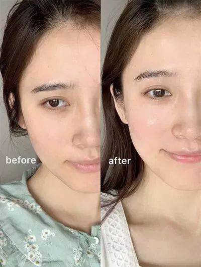 坚决不做“黄脸婆”!有了它,再差的皮肤都有救!丨开团