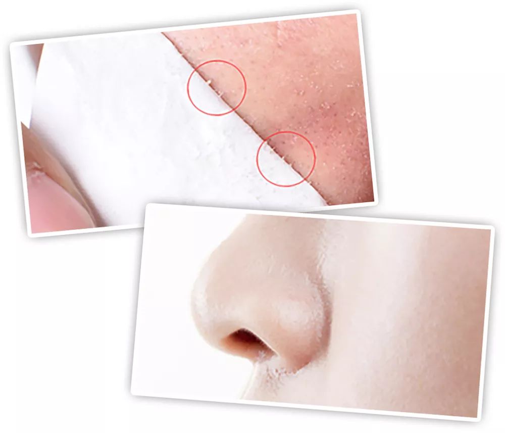 坚决不做“黄脸婆”!有了它,再差的皮肤都有救!丨开团