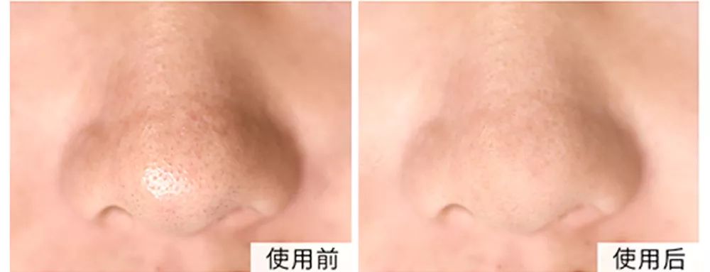 坚决不做“黄脸婆”!有了它,再差的皮肤都有救!丨开团