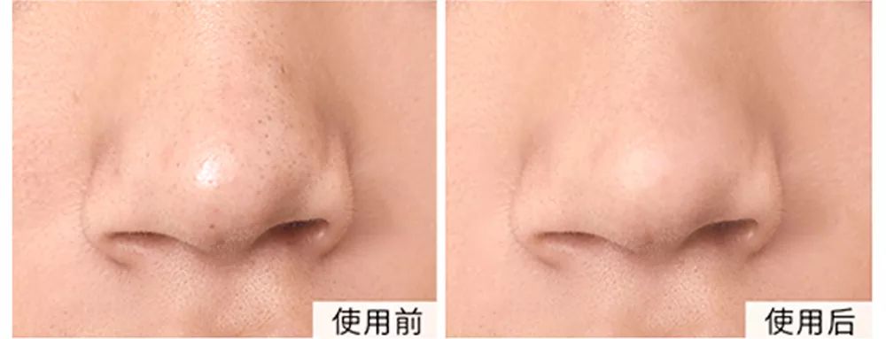 坚决不做“黄脸婆”!有了它,再差的皮肤都有救!丨开团