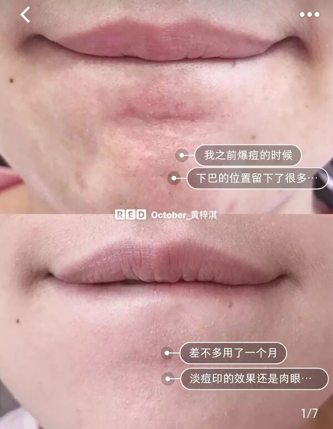 秋天必备的4款单品鞋,秋天穿的小白鞋