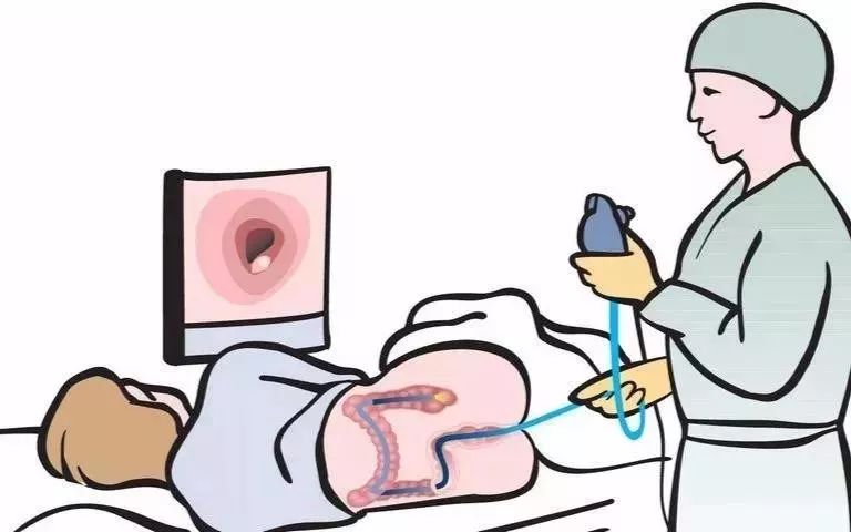 大肠有息肉用手术吗,大肠长息肉了怎么办