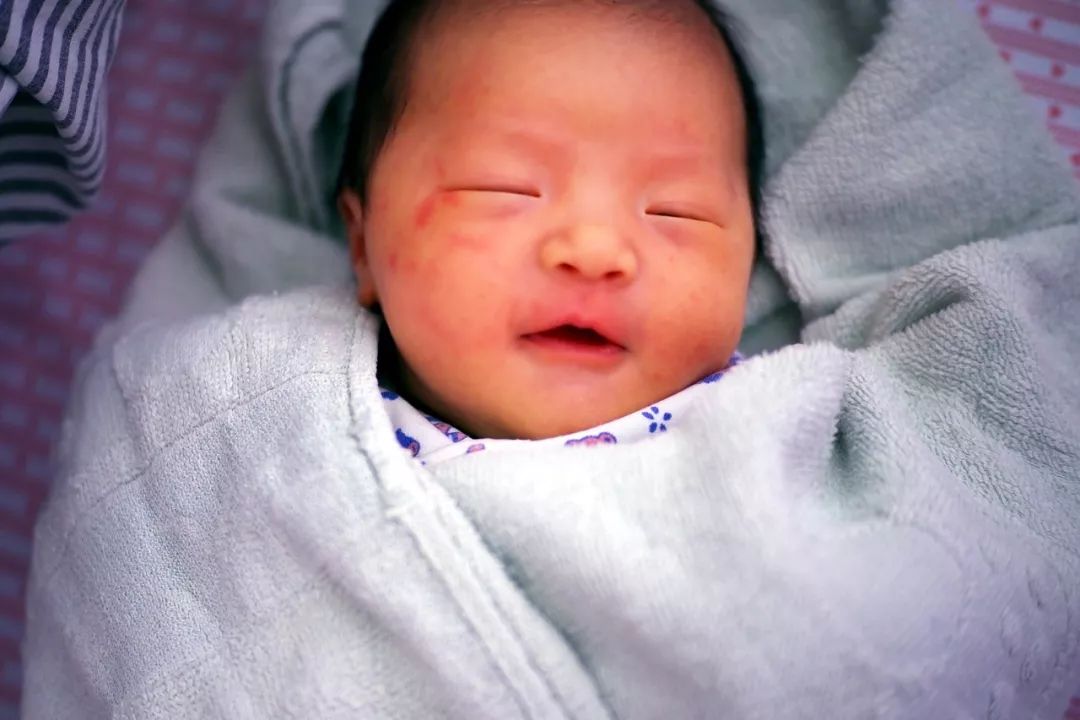 养娃必备的10种非处方药，你备了几种？