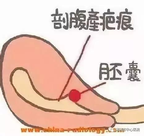 哪些妇科疾病需要进行手术治疗,微创介入治疗妇科疾病