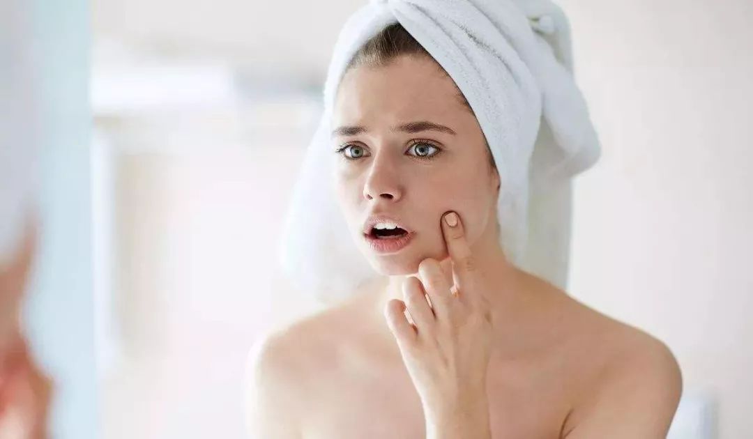 战痘最全“3+6”攻略！治疗分三级，护理注意六点