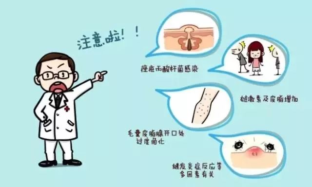 战痘最全“3+6”攻略！治疗分三级，护理注意六点