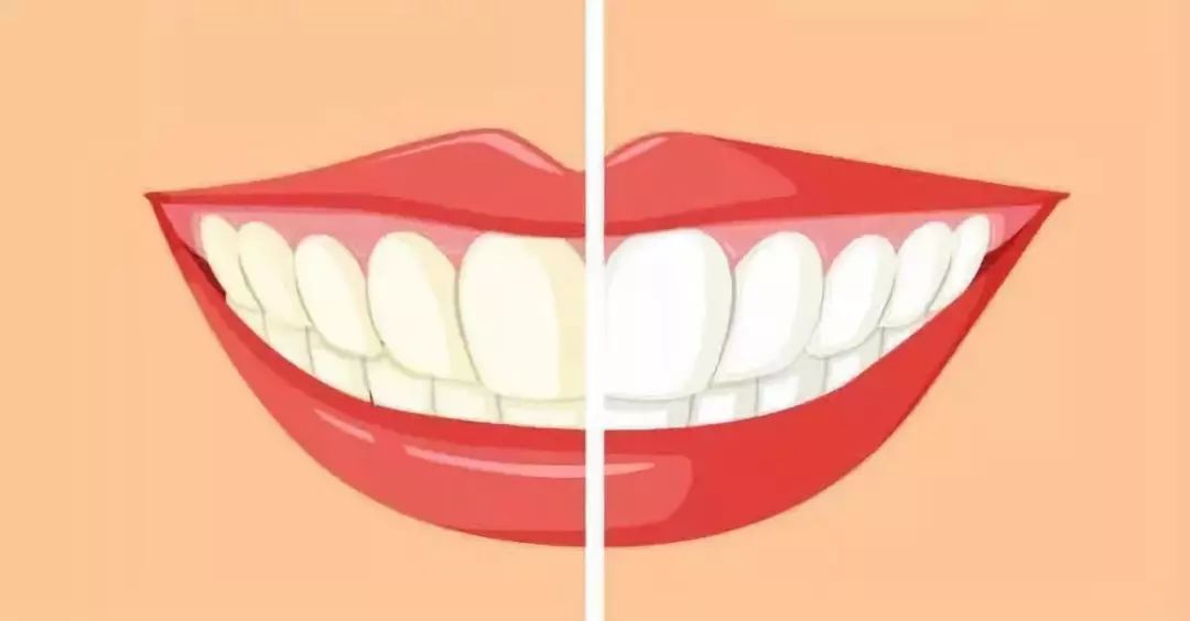 刚刷完牙有必要用漱口水吗,刷完牙有必要用漱口水么