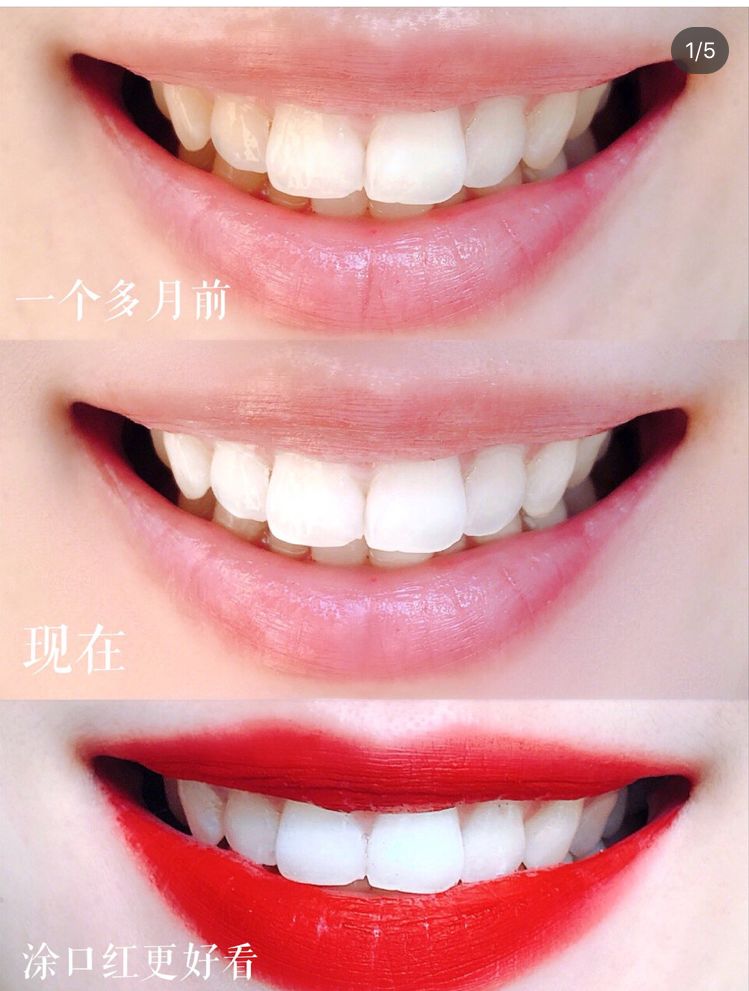 俄罗斯牙膏美白去口臭牙黄,去牙垢黄牙的牙膏测评