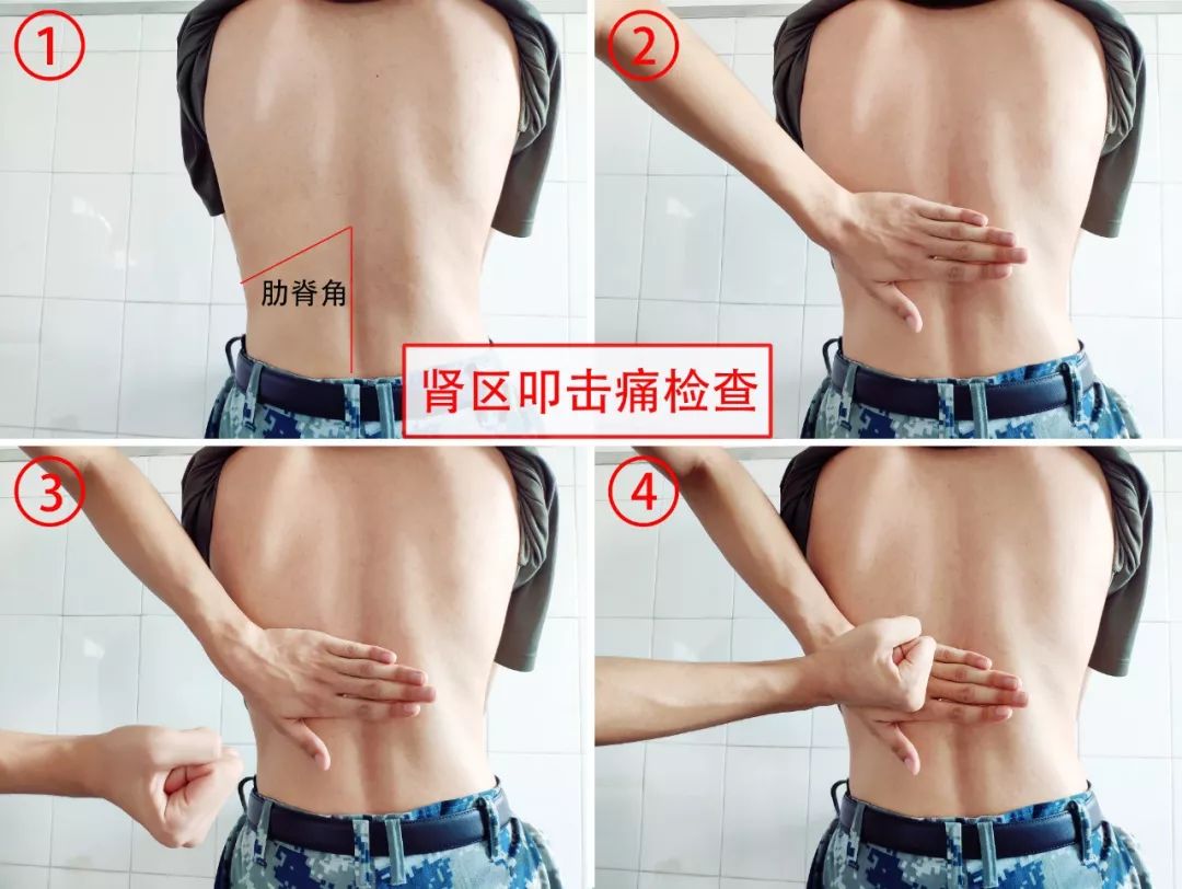 军医在线|多饮水、勤排尿,远离尿路感染没烦恼