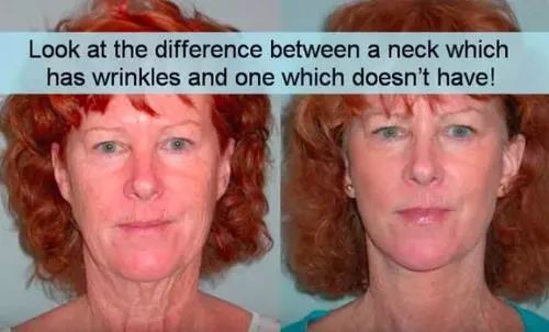 这款急救弹性蛋白贴,每天一片赶走干纹,还你天鹅美颈