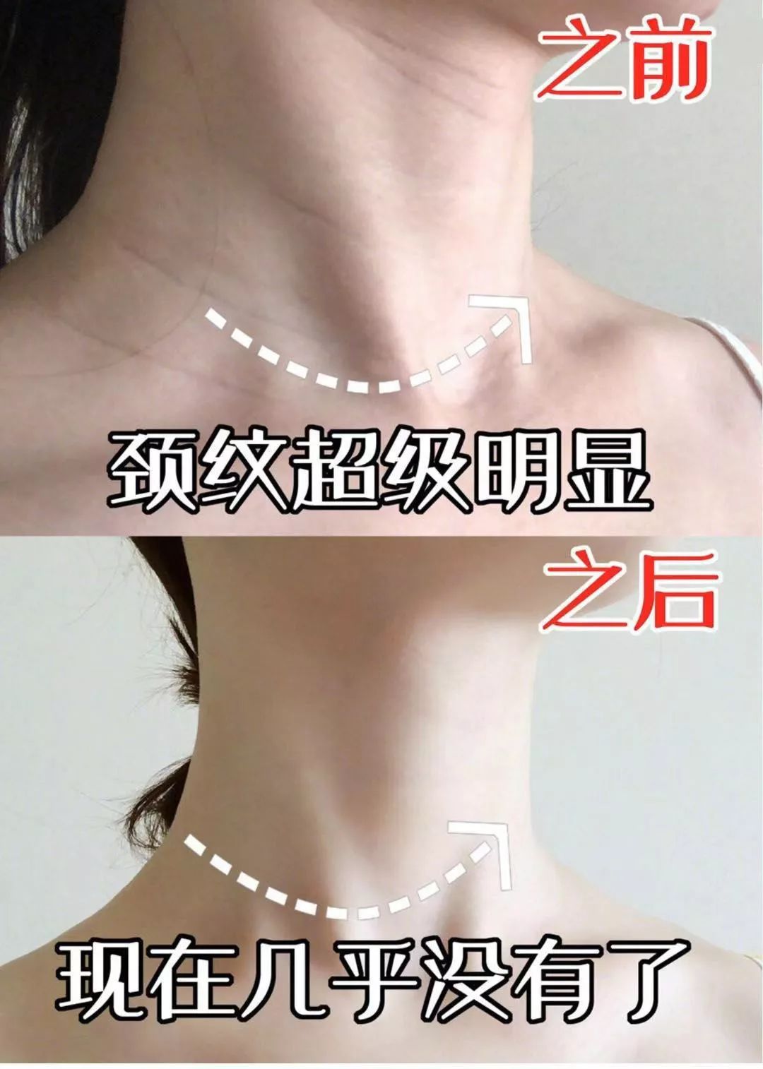 这款急救弹性蛋白贴,每天一片赶走干纹,还你天鹅美颈