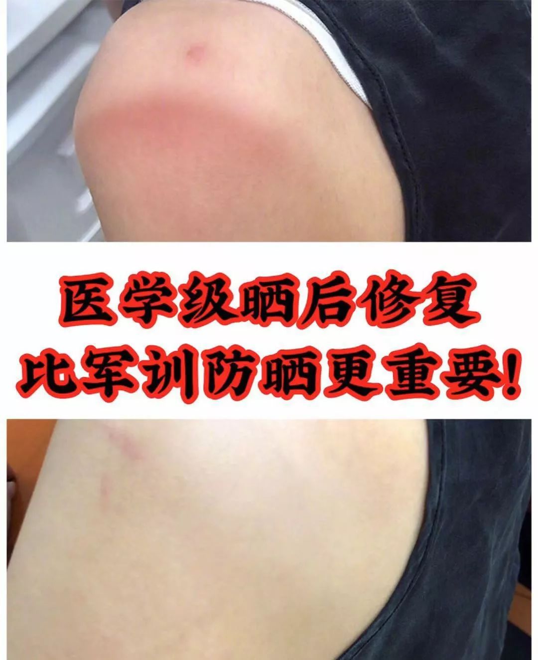 这款急救弹性蛋白贴,每天一片赶走干纹,还你天鹅美颈