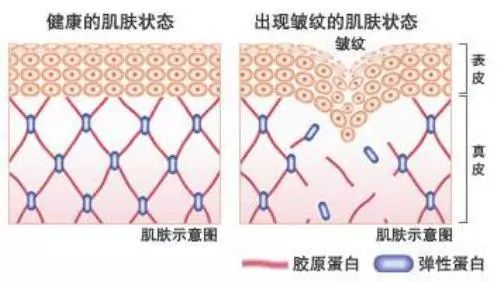 这款急救弹性蛋白贴,每天一片赶走干纹,还你天鹅美颈